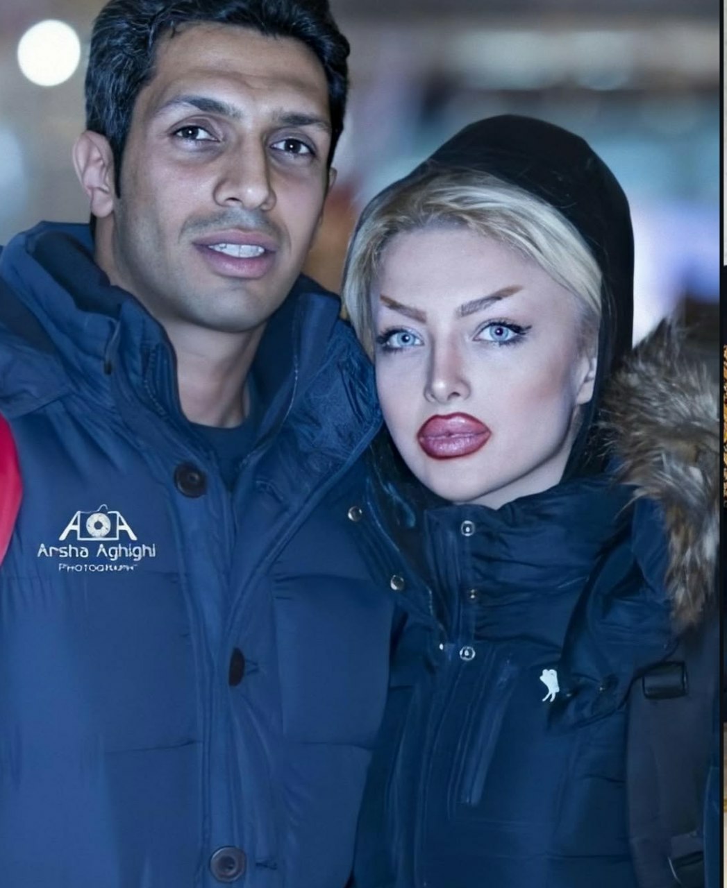 عکس همسر سپهر حیدری قبل عمل