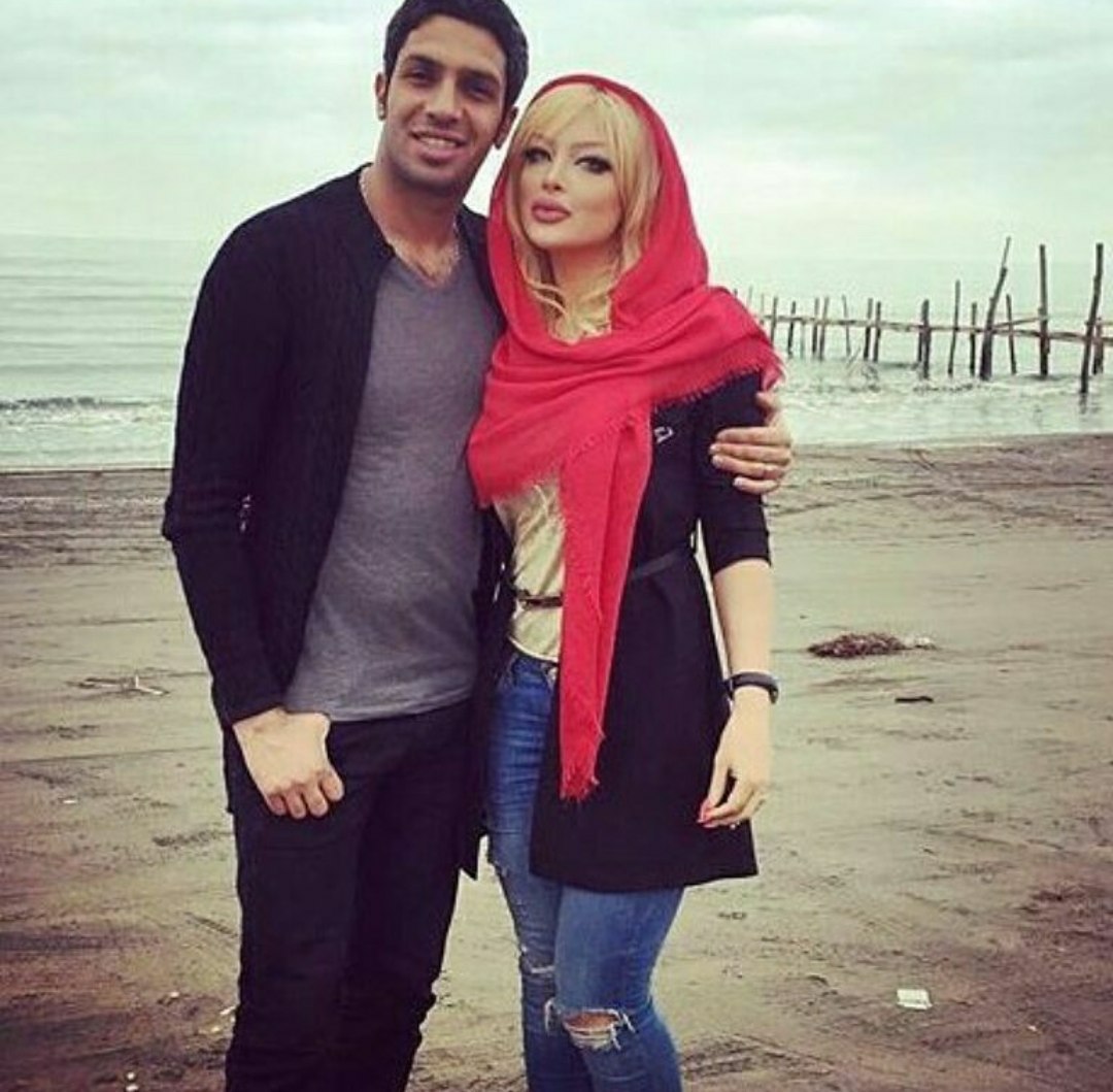 عکس همسر سپهر حیدری قبل از عمل