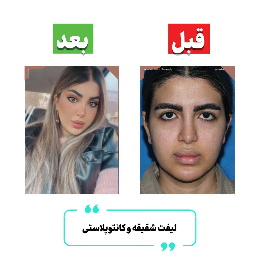 دکتر مهدی احمدی قبل و بعد دکتر مهدی احمدی قبل و بعد