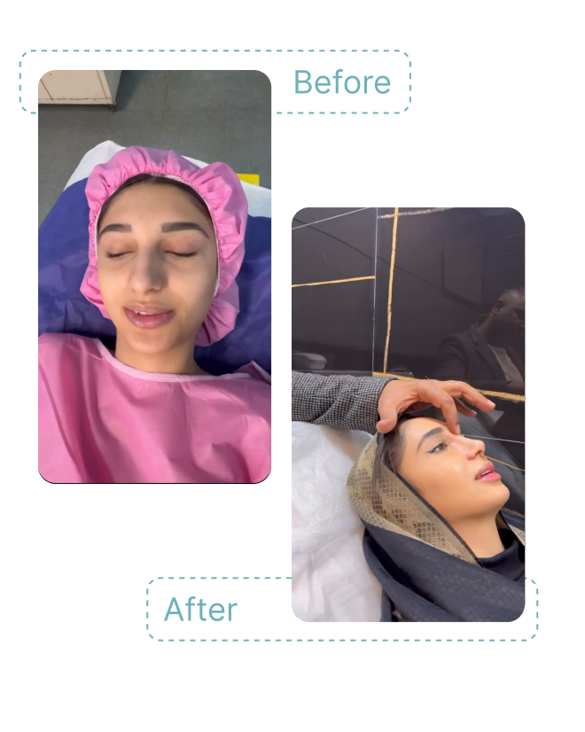 دکتر کامبیز ایزدپناه قبل و بعد دکتر کامبیز ایزدپناه قبل و بعد