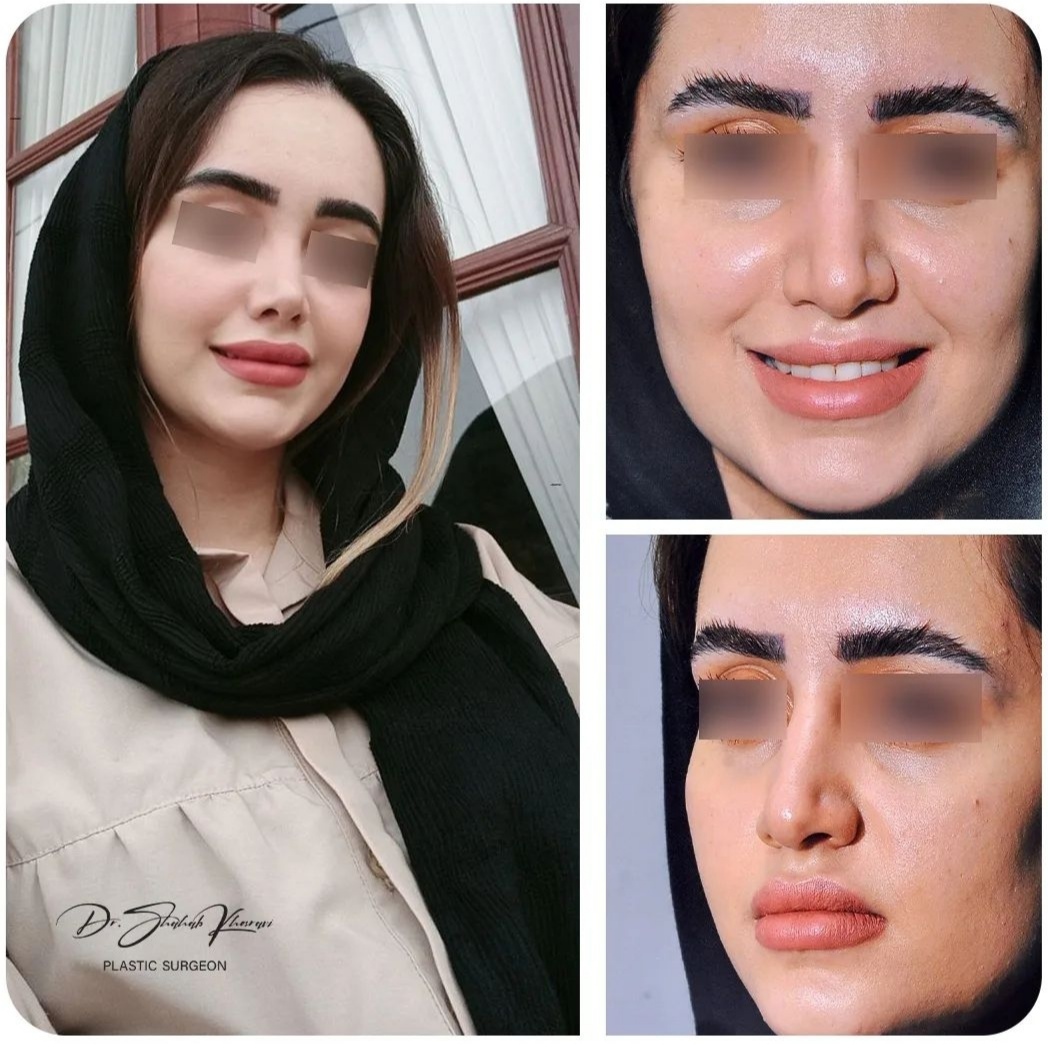 دکتر شهاب خسروی قبل و بعد