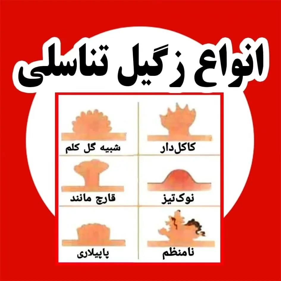 انواع زگیل‌های تناسلی 