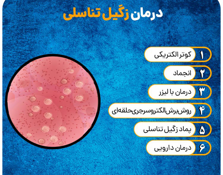 درمان زگیل‌ تناسلی