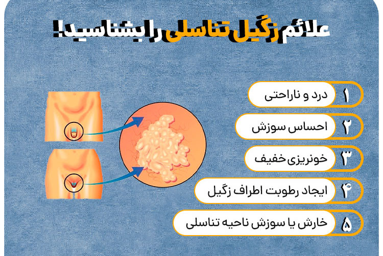 علائم زگیل تناسلی