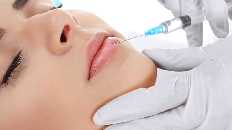 چرا فیلرها نیاز به تمدید دارند