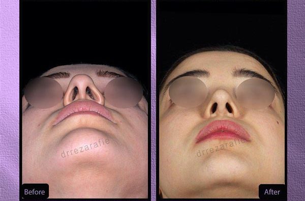 دکتر سید رضا رفیع قبل و بعد دکتر سید رضا رفیع قبل و بعد