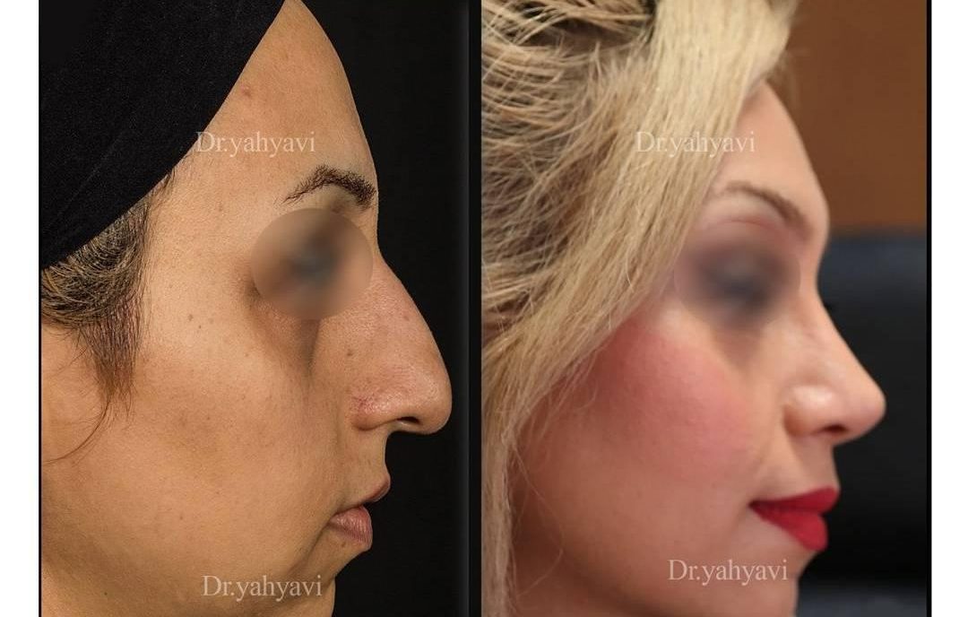 دکتر شهریار یحیوی نمونه کار دکتر شهریار یحیوی نمونه کار