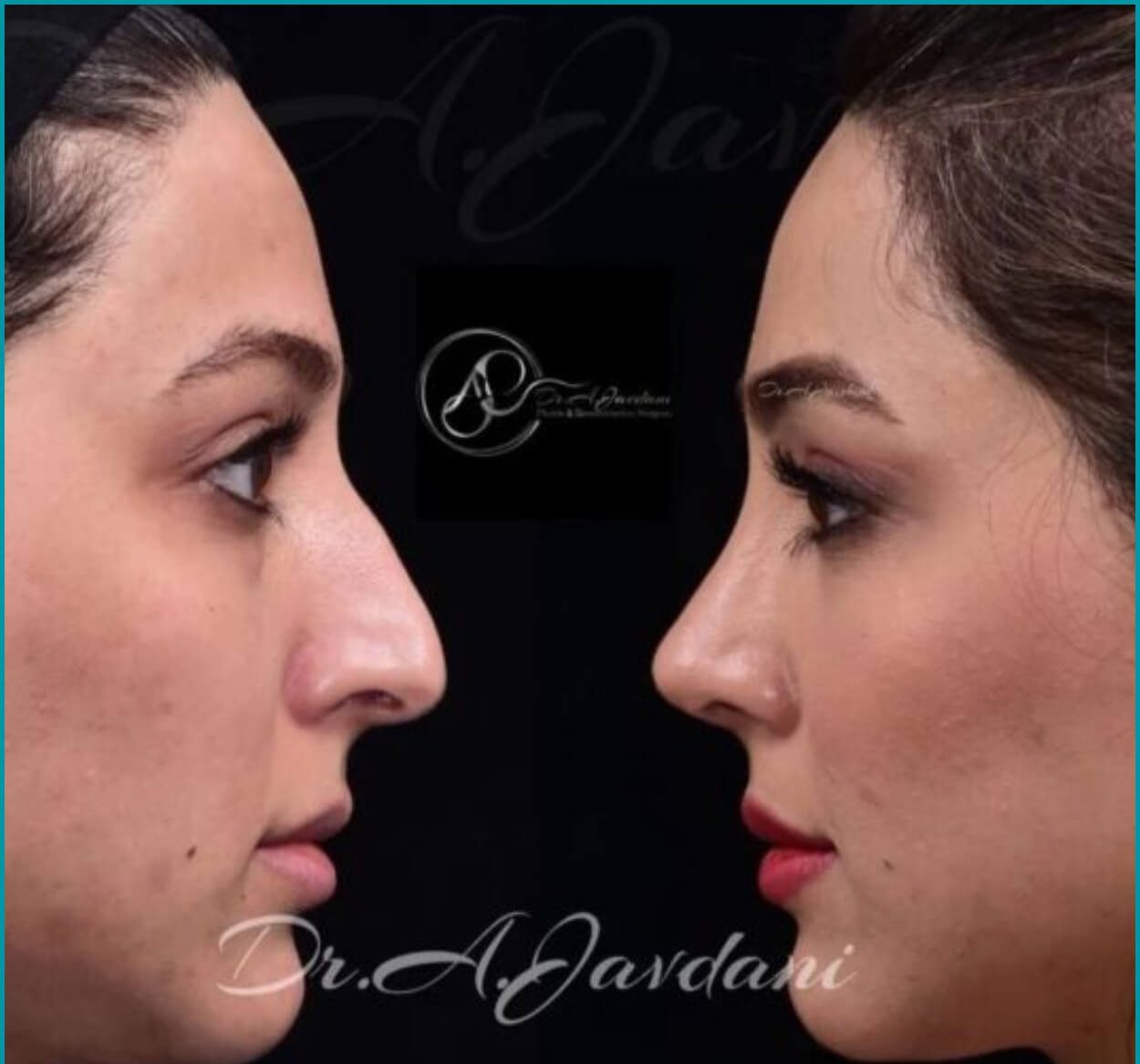 دکتر علی جاودانی قبل و بعد دکتر علی جاودانی قبل و بعد