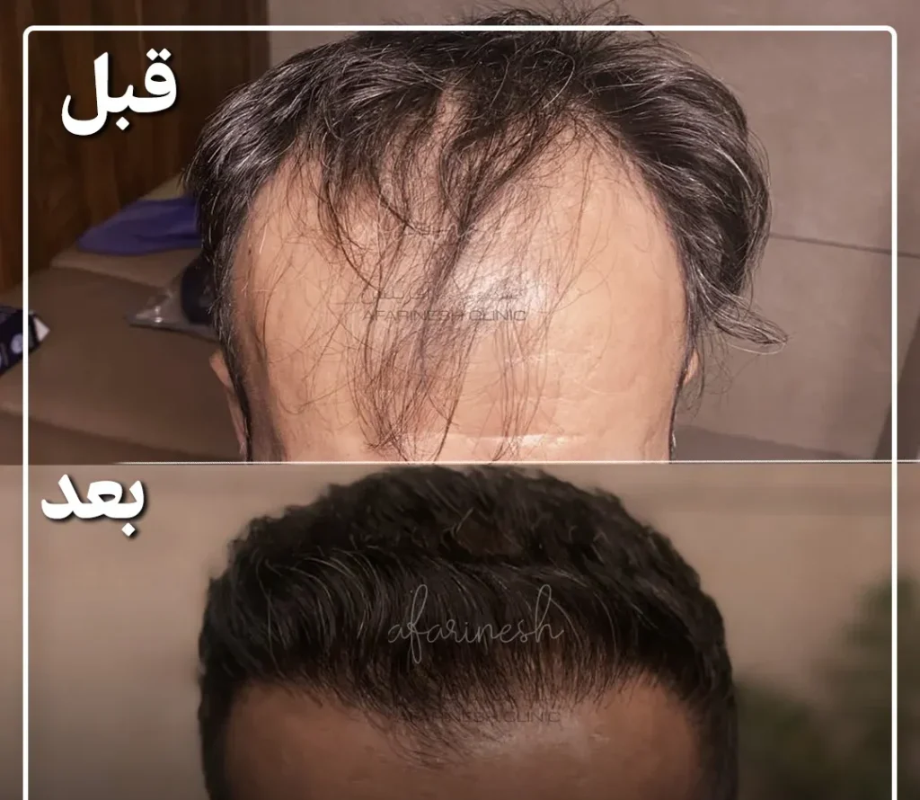 محمد علی نیلفروش زاده نمونه کار محمد علی نیلفروش زاده نمونه کار